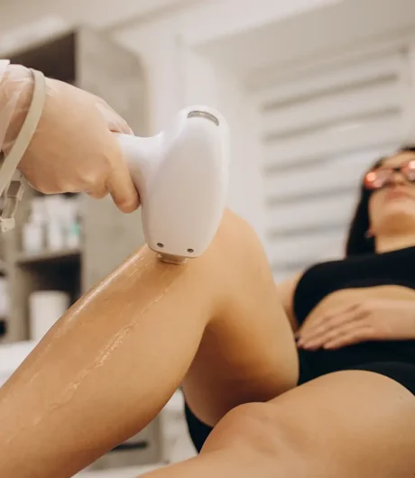 epilation-definitive epilation-definitive