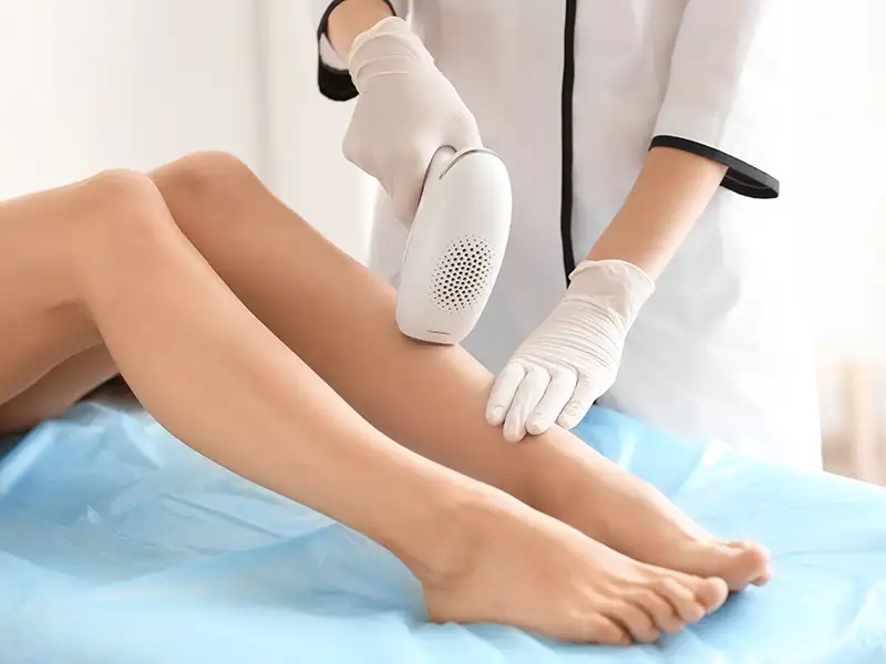 epilation-definitive-full epilation-definitive-full